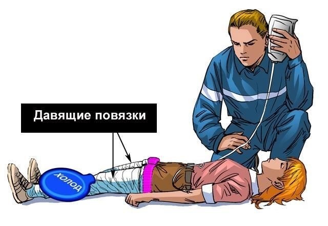 Травмы от раздавливания: Часто встречаются при авариях или насильственных нападениях и могут вызвать значительное повреждение тканей, что при отсутствии своевременного лечения может привести к долгосрочным последствиям.
