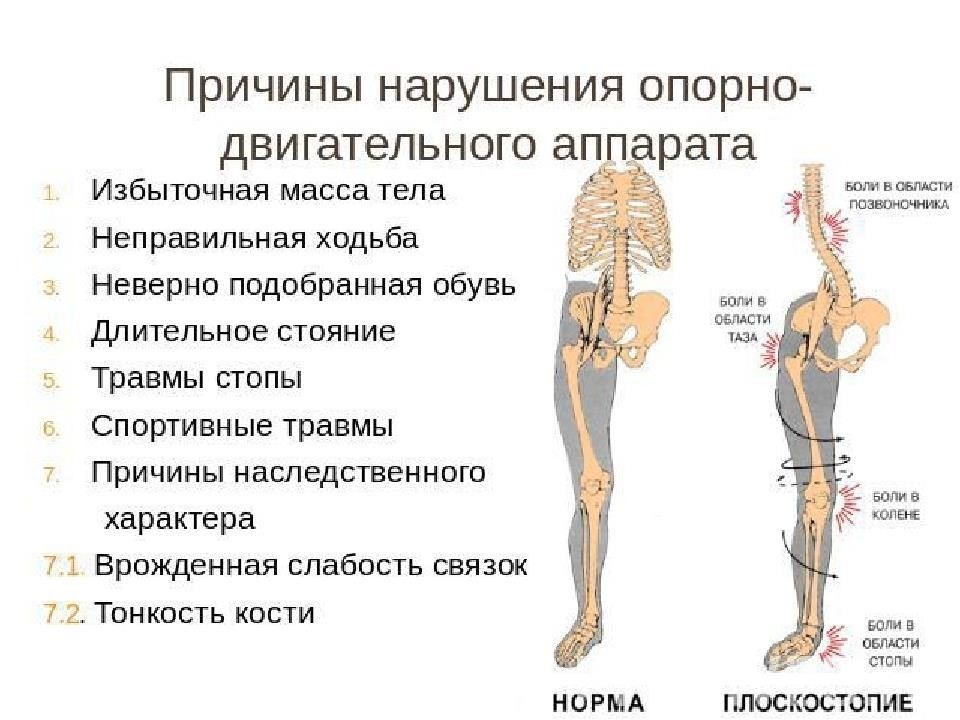 2. Расстройства опорно-двигательного аппарата