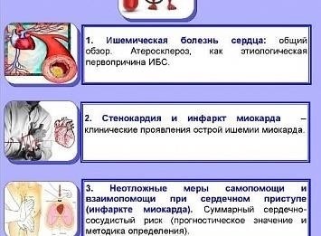 Влияние диастолической дисфункции на сердечно-сосудистую гемодинамику при ишемической болезни сердца