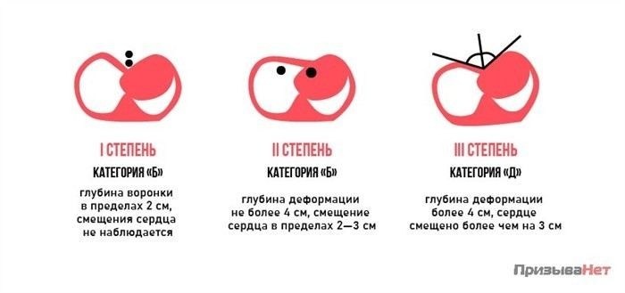 Какие виды деформации грудной клетки могут повлиять на призыв?