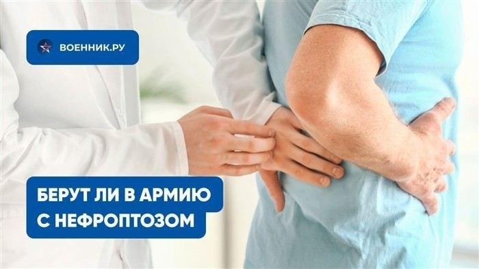 Что такое нефроптоз и какие степени заболевания учитывает военкомат в 2026 году