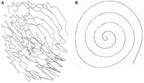 Как тремор рук влияет на решение медицинской комиссии