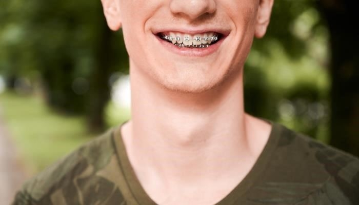 Необходимая документация для будущих солдат с зубными аппаратами