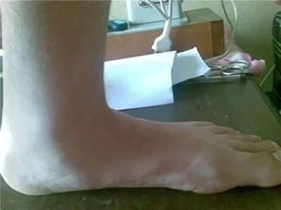 Как получить диагноз от военного комиссариата?