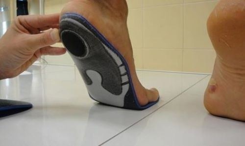 Как влияет плоскоступие третьей степени на призывную годность?