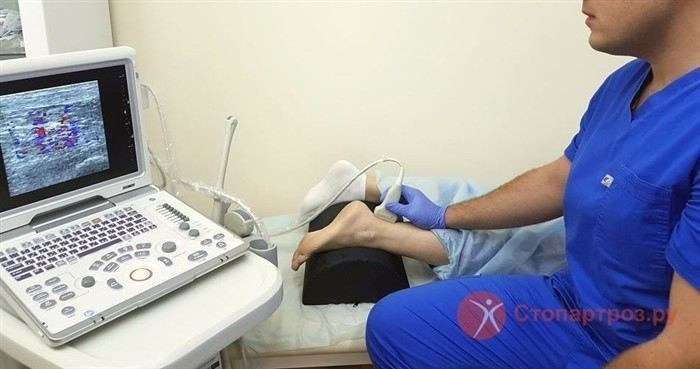 Методы диагностики артроза таранно-ладьевидного сустава