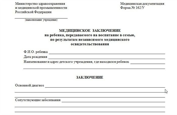 Условия для получения временной опеки