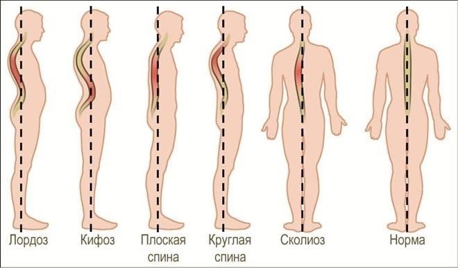 Права, предоставляемые в соответствии с кодексом 66, и налагаемые ограничения