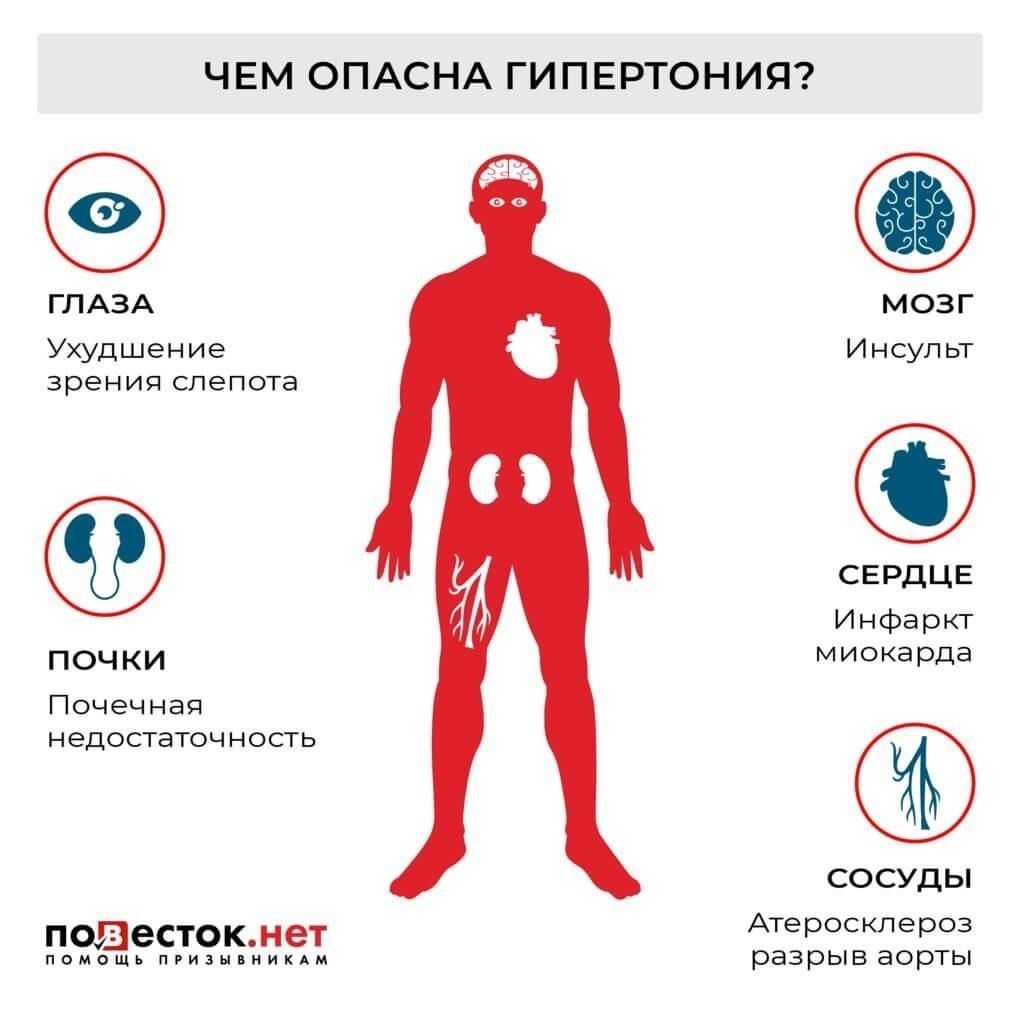 Медицинские критерии для призыва в армию с гипертонией