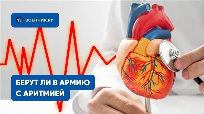 Аритмия и категории годности по 