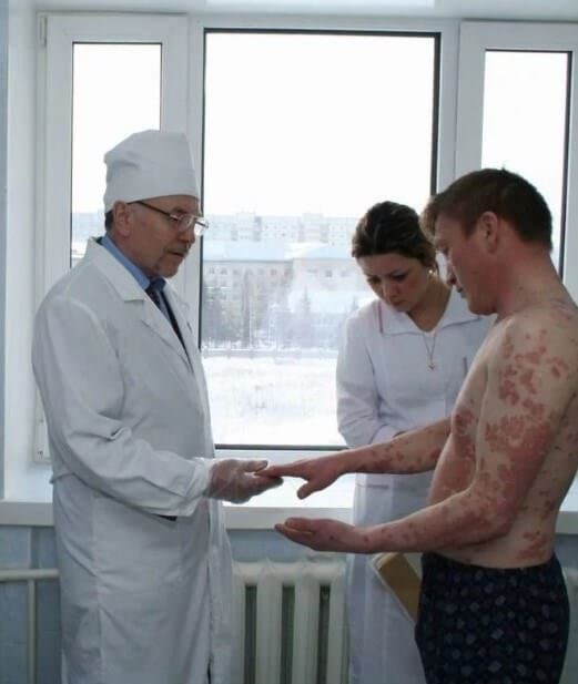 Псориаз и военный призыв: Является ли это дисквалифицирующим фактором?