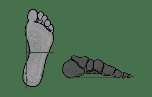 Какие категории годности к военной службе существуют при плоскостопии