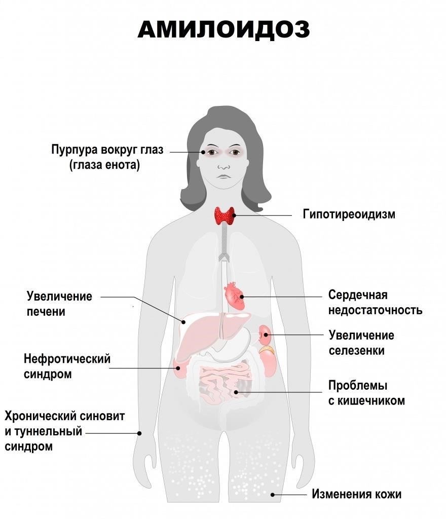 Также могут быть назначены тесты для оценки повреждения органов, например, функции почек или сердца. К ним относятся анализы крови для оценки состояния почек и ЭКГ (электрокардиограмма) для проверки сердечных отклонений.