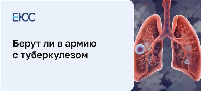 Законодательные нормы и медицинские критерии для призывников с туберкулезом